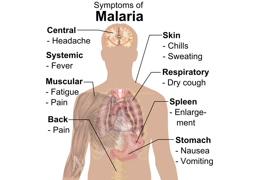 Gejala malaria | Wikimedia Commons