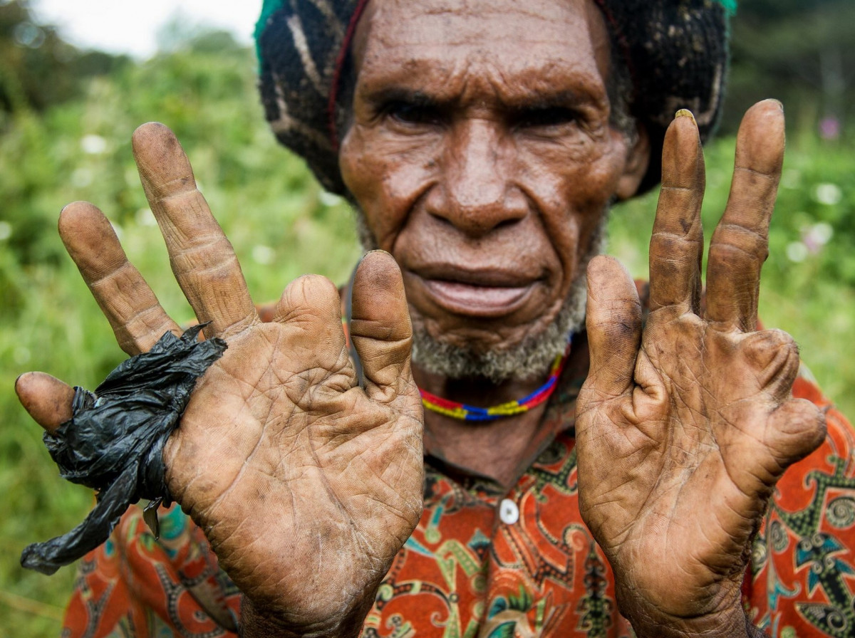 Tradisi Potong Jari, salah satu tradisi horor dan menyeramkan asal Suku Dani Papua Indonesia