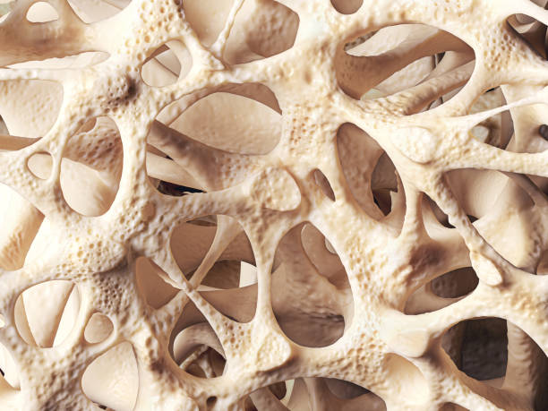 Struktur tulang yang mengalami osteoporosis | Foto: Eranicle/istockphoto.com